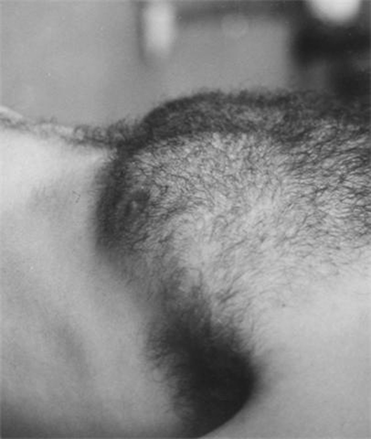 Darío Villalba, Torso, 2010